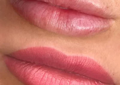Lippenkonturierung