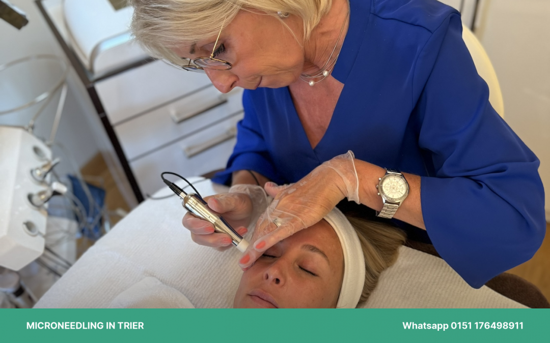 MICRONEEDLING IN TRIER – WIE DEINE HAUT SICH SELBST ZU MEHR STRAFFHEIT VERHILFT