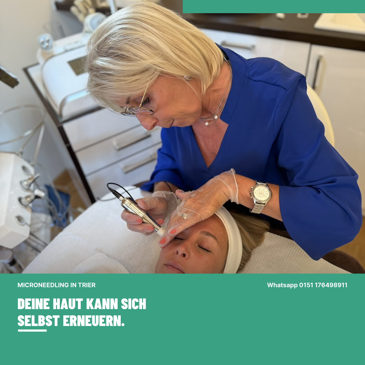 Microneedling Behandlung in der Beauty Lounge Trier bei Heike Maringer-Reif