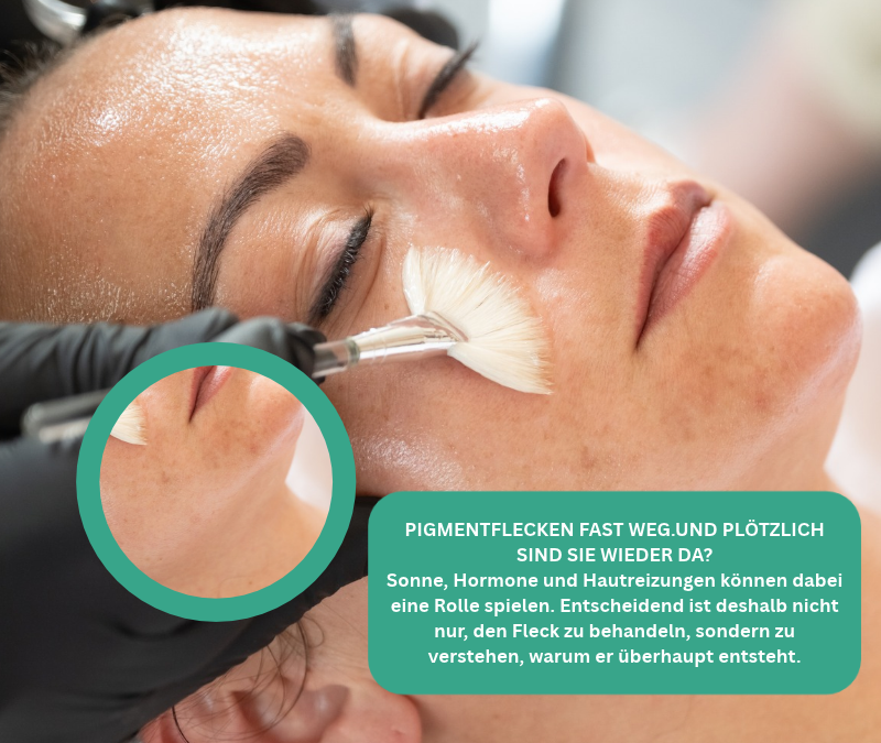 Professionelle Gesichtsbehandlung mit Pinsel bei Pigmentflecken im Gesicht in der BEAUTYLOUNGE Trier von Heike Maringer-Reif.
